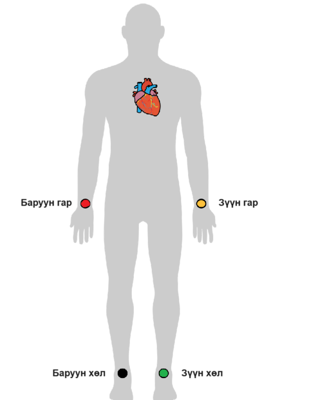 Зүрхний цахилгаан бичлэг ЭКГ (Electrocardiography ECG) - ErdeMED